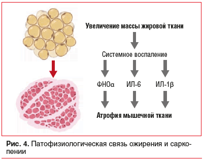 1768327354_96_Sarkopenicheskoe-ozhirenie-u-patsientov-s-serdechno-sosudistymi-zabolevaniyami-skriningovoe-issledovanie-na.png